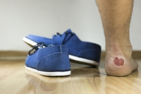 Possible Causes for Blisters on the Feet