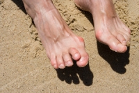 Can Hammertoe Be Prevented?