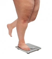 How the Feet Are Affected by Childhood Obesity