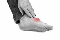 Gout Is a Form of Arthritis