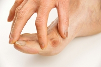 Yoga May Help to Prevent Bunion Pain