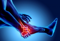 The Anatomy of a Foot Stress Fracture