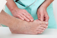 Treatments for Bunions